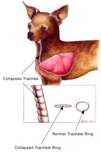 collapsedtrach